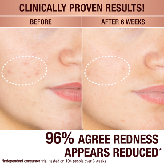 Charlotte Tilbury Dark Spot Correcting Radiance Recovery Serum 30ml