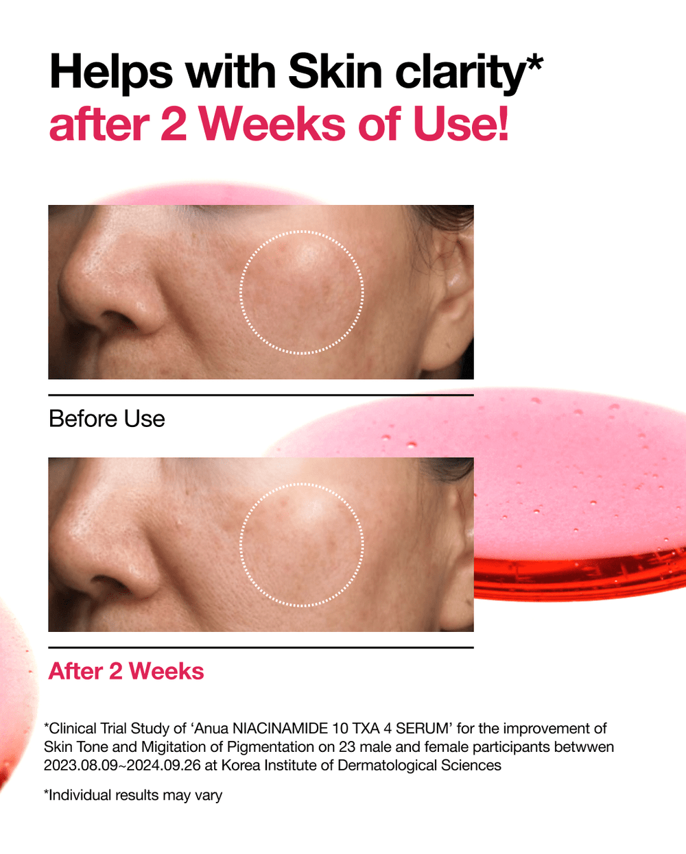 Anua Niacinamide 10% + TXA 4% Dark Spot Corrector Serum(New Packaging)