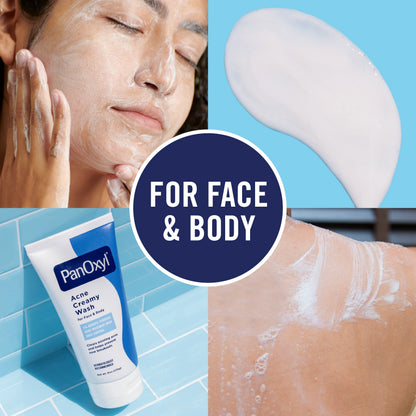 PanOxyl Acne Creamy Wash 170g