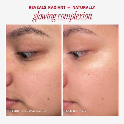 First Aid Beauty 
Brighten + Glow Facial Radiance Pads with Glycolic + Lactic Acids 28pads
