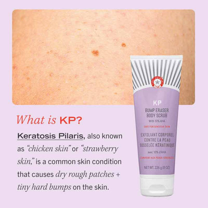 First Aid Beauty KP Bump Eraser Body Scrub with 10% AHA 56.7g