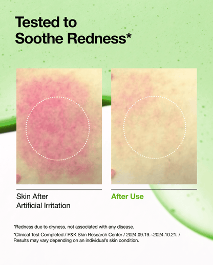 Anua Azelaic Acid 10 Hyaluron Redness Soothing Serum - 30ml