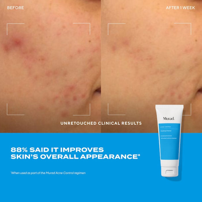 Murad Clarifying Gel Cleanser with Dual Salicylic Acid for Acne-Prone Skin 150