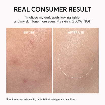 Arencia TXA Booster Shot | Advanced Brightening Serum