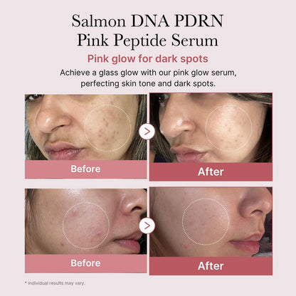 Medicube PDRN Pink Peptide Serum 30ml
