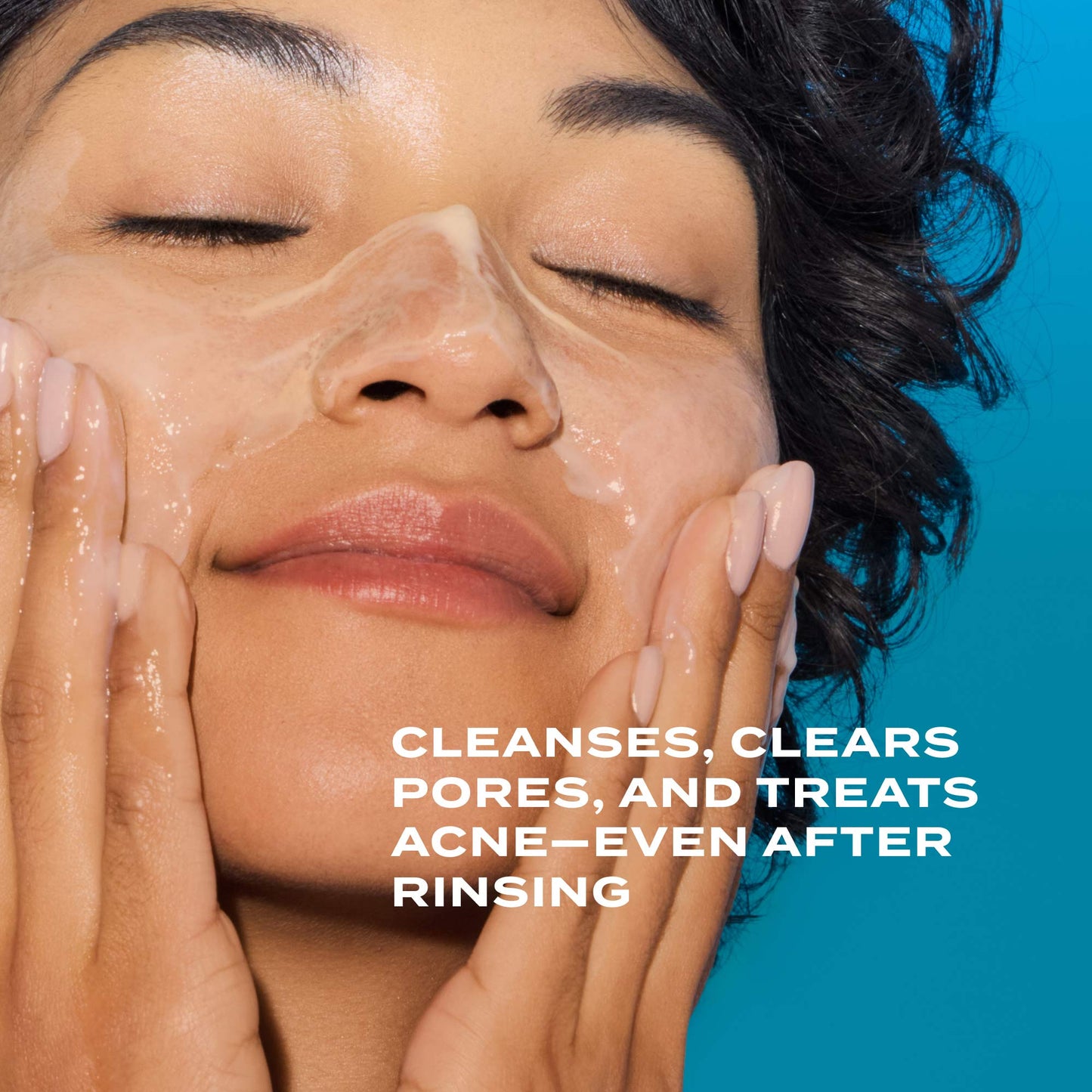 Murad Clarifying Gel Cleanser with Dual Salicylic Acid for Acne-Prone Skin 150