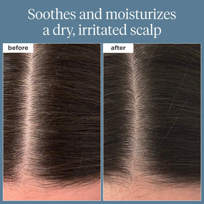 Briogeo Mini Scalp Revival™ Rosemary Pre-Wash Scalp and Hair Oil 30ml