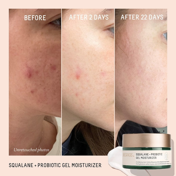 Biossance 
Probiotic Balancing Gel Moisturizer + Squalane 5ml