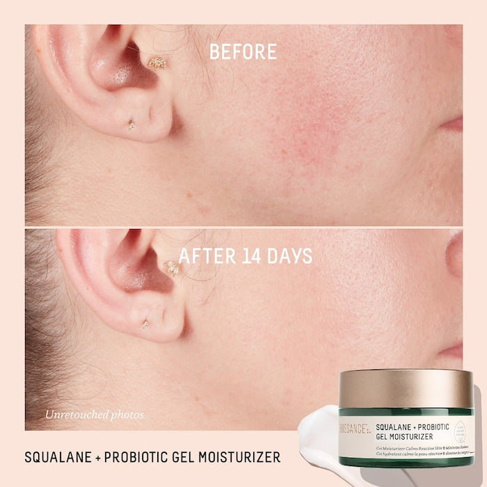 Biossance 
Probiotic Balancing Gel Moisturizer + Squalane 5ml