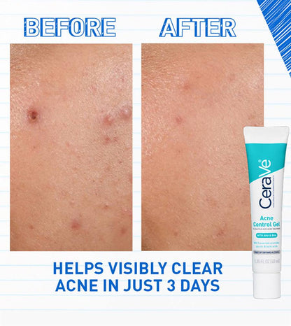 Cerave Acne Control Gel 2% SALICYLIC ACID ACNE TREATMENT 40ml