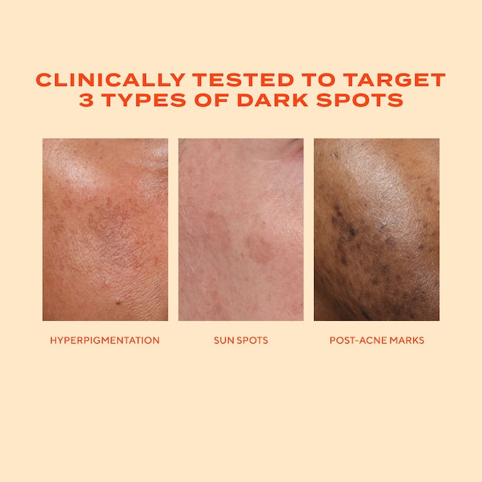 Murad 
Rapid Dark Spot Correcting Serum with Glycolic and Tranexamic Acid 30ml