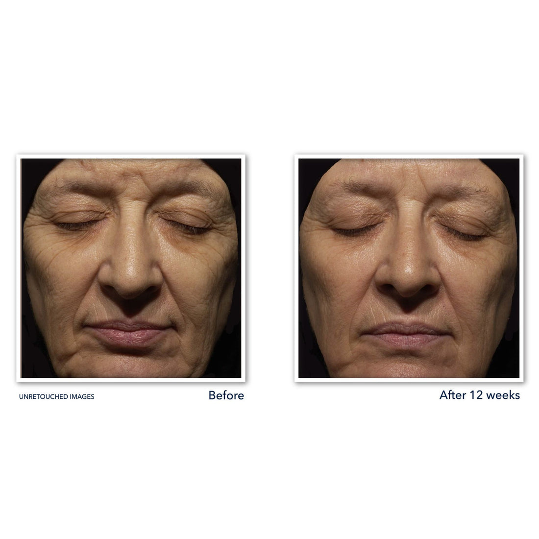 Roc RETINOL CORREXION® DEEP WRINKLE NIGHT CREAM