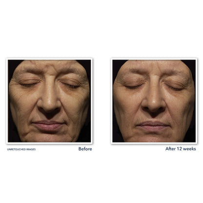 Roc RETINOL CORREXION® DEEP WRINKLE NIGHT CREAM