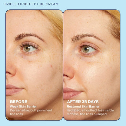 Skinfix  barrier+ Strengthening and Moisturizing Triple Lipid-Peptide Cream 15ml