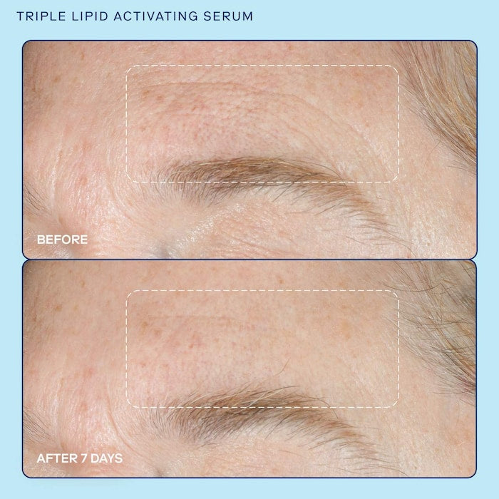 Skinfix barrier+ Triple Lipid + Niacinamide Activating Serum 10ml